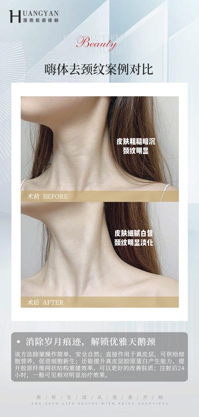 南门网 广告 海报 医美 案例 对比 脖子 颈部