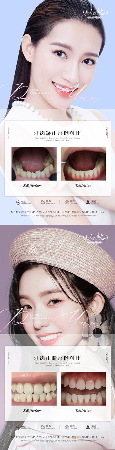 南门网 海报 医美 口腔 牙科 案例 对比 简约 人物 牙齿 矫正 畸形