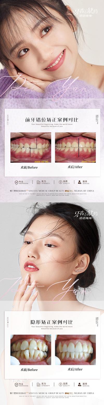南门网 海报 医美 口腔 牙科 案例 对比 简约 人物 牙齿 前牙