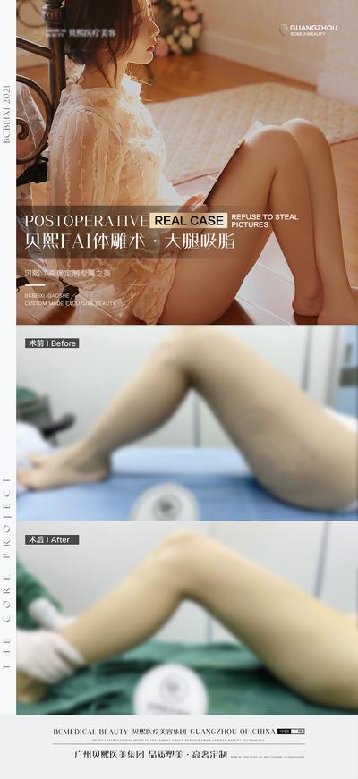 南门网 海报 医美 案例 对比 整形 瘦腿