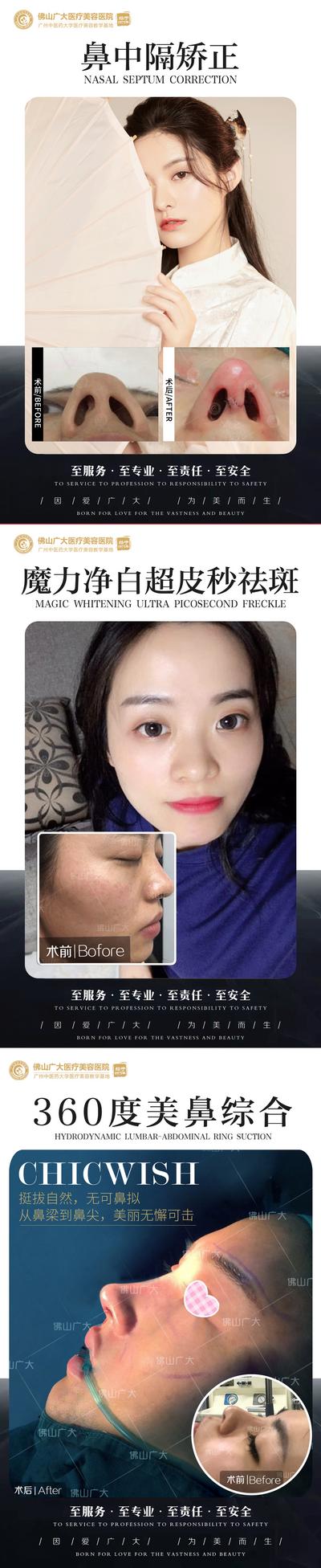 【南门网】海报 医美 人物对比 项目 案例 鼻综合 鼻修复 鼻中隔 祛斑