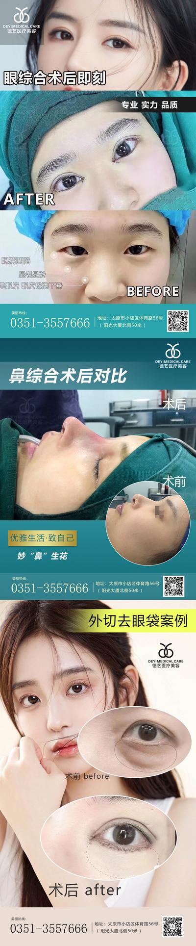 【南门网】海报 医美 整形 案例 对比 人物 祛抬头纹 玻尿酸 填充