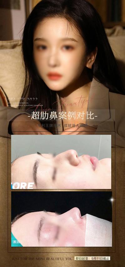 南门网 海报 医美 活动 隆鼻 人物 促销 美容 皮肤 案例 对比
