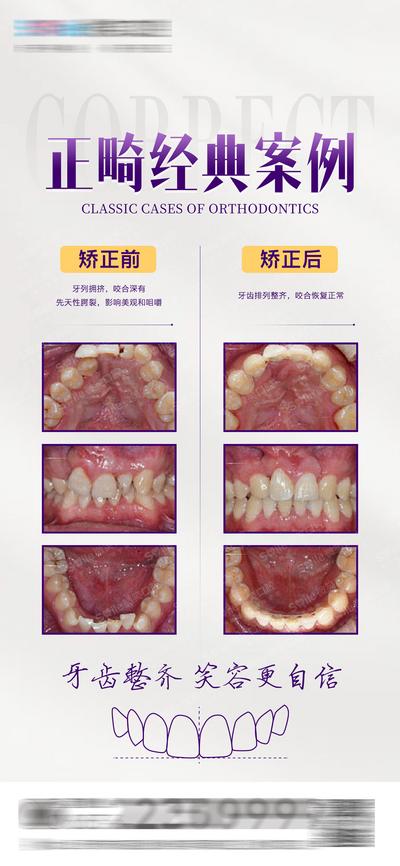 【南门网】海报 医美 正畸 口腔 案例对比 牙齿 矫正 牙齿线稿 种植牙