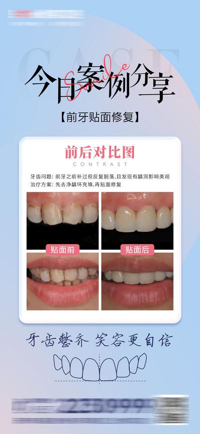 【南门网】海报 医美 口腔 案例 分享 对比 牙齿 齿科 贴面 美白 牙齿线稿 简约 大气