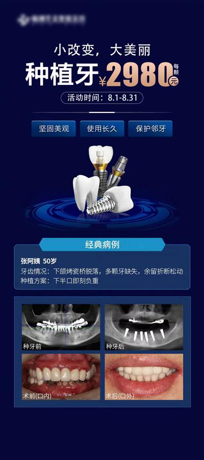 南门网 广告 海报 医美 种植牙 案例 对比 病例 邻牙 美丽 缺失 口腔 牙齿 爆款 价格