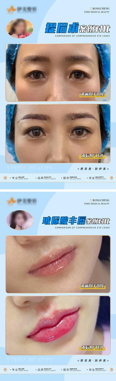 南门网 广告 海报 医美 对比 案例 眉毛 玻尿酸 唇